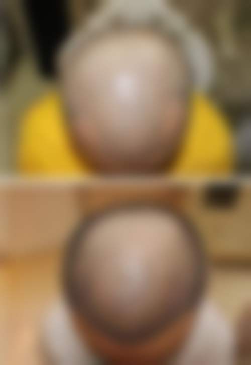 五、上海市沪中医疗美容医院(长宁院区)实例