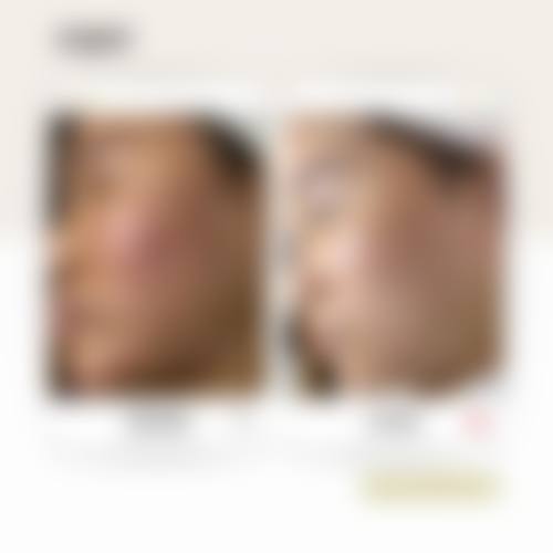 五、北美Skin Clinic实例