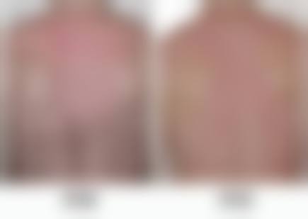 六、北美Skin Clinic怎么预约: