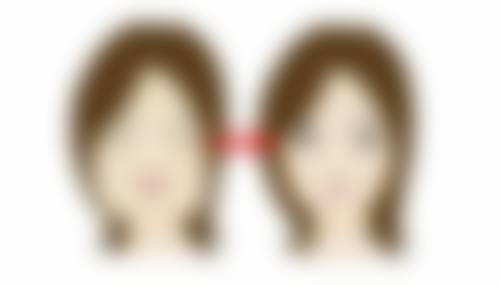 割双眼皮究竟算不算整容？了解手术类型、效果及护理，开启美丽蜕变之旅 