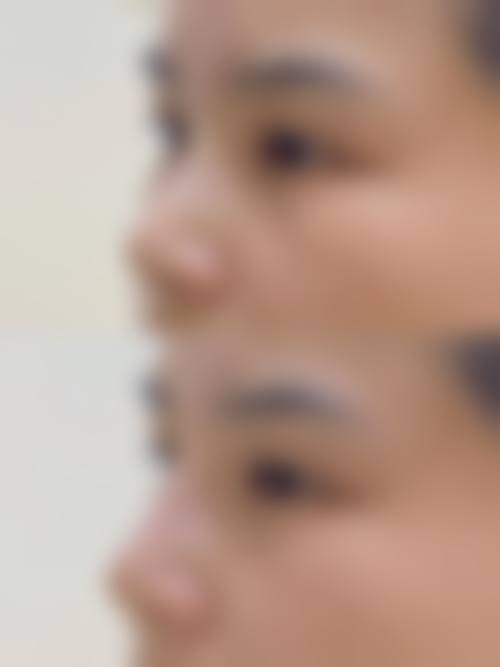 八、常州索玛汀整形医院真实的顾客评价如下：