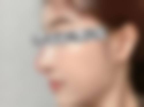 刘赞医生口碑和评价