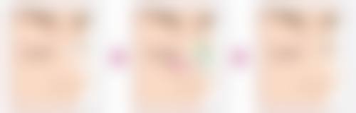 阴道紧缩术的优势有哪些？