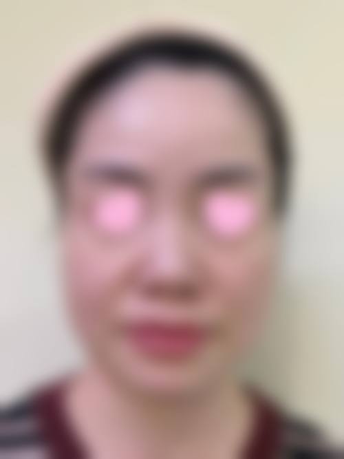 五、北京台娢医疗美容诊所实例
