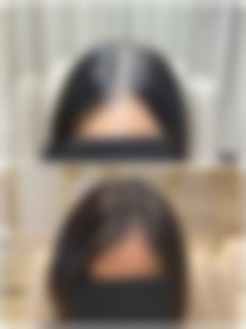 余正伦医生怎么样可靠吗？