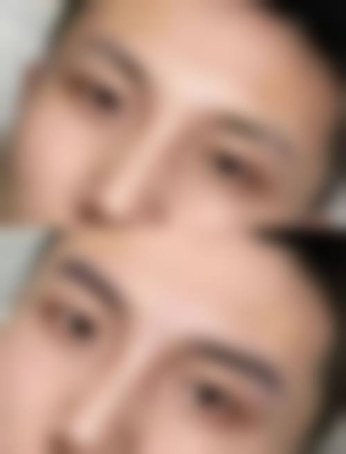 五、泰州百年植发医疗美容诊所怎么预约：