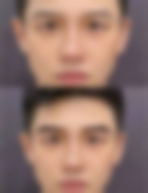 六、泰州百年植发医疗美容诊所价格表：（仅供参考）