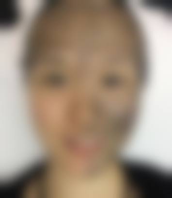 麦慧医生在哪家医院怎么预约？