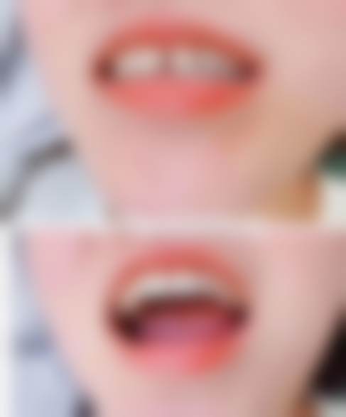 八、广州壹加壹美容医院真实的顾客评价如下：