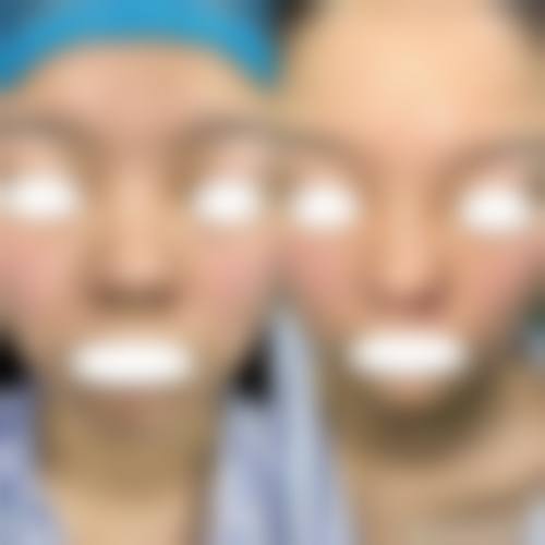 占洁医生怎么样可靠吗?