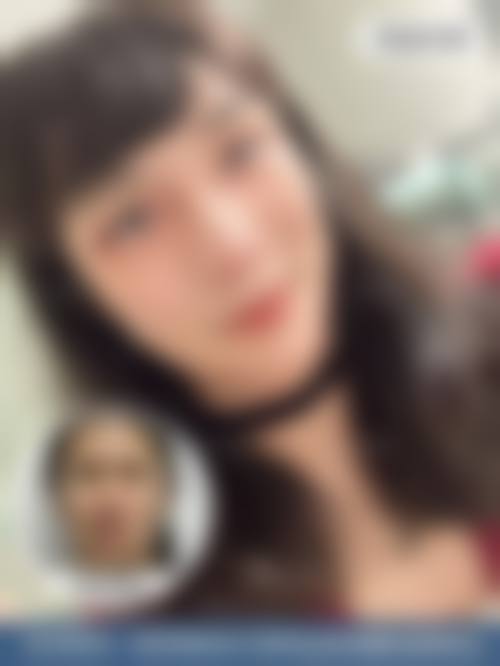 八、杭州余杭区第一人民医院整形科真实的顾客评价如下: