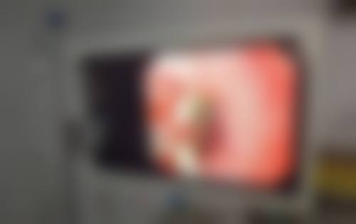 七、韩国真下知外科整形真实的顾客评价如下: