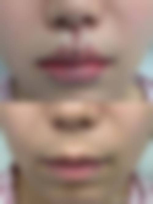 许菲菲医生在哪家医院怎么预约?