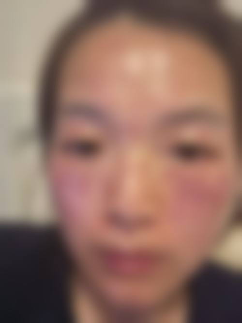 六、天津市人民医院整形外科怎么预约：