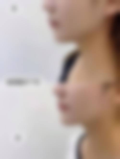 胡南医生实例