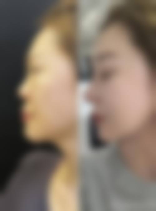 四、蒲江美丽部落敏琴医疗美容诊所实例