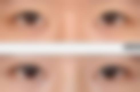 六、湖南圣雅医疗美容医院怎么预约: