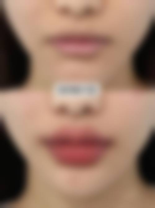 八、北京玛丽整形医院真实的顾客评价如下:
