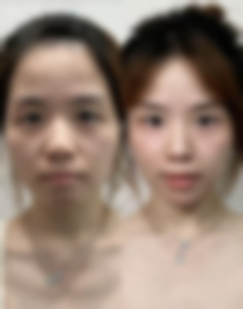 六、张店诚美医疗美容诊所价格表:(仅供参考)