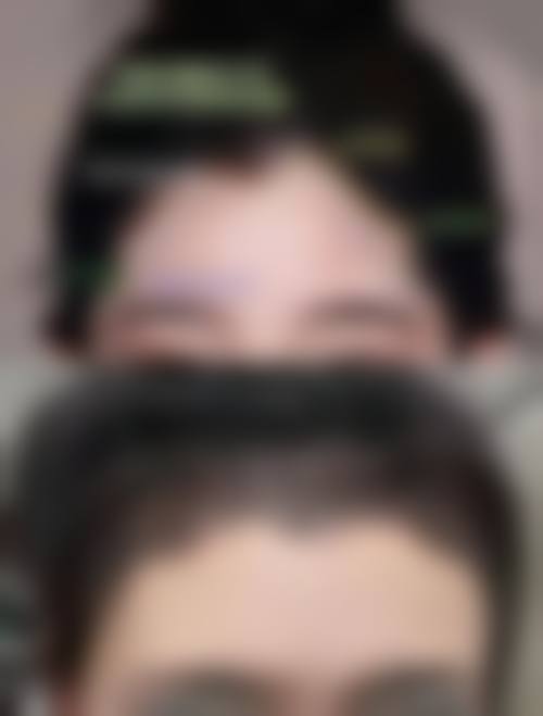 七、武汉显赫植发医院价格表:(仅供参考)