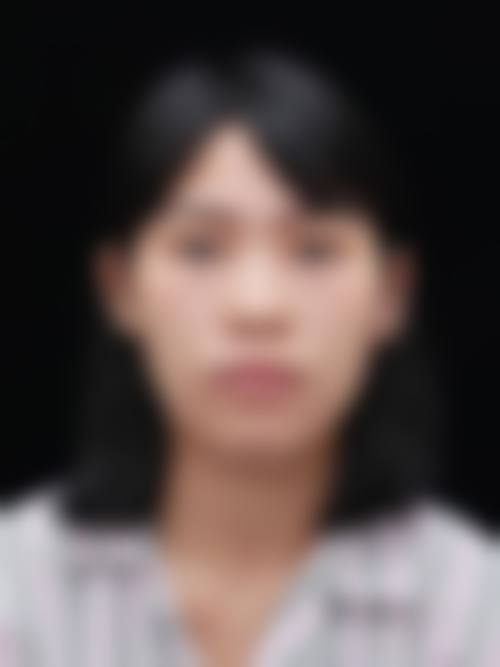 七、广州天美新生医疗美容门诊价格表：（仅供参考）