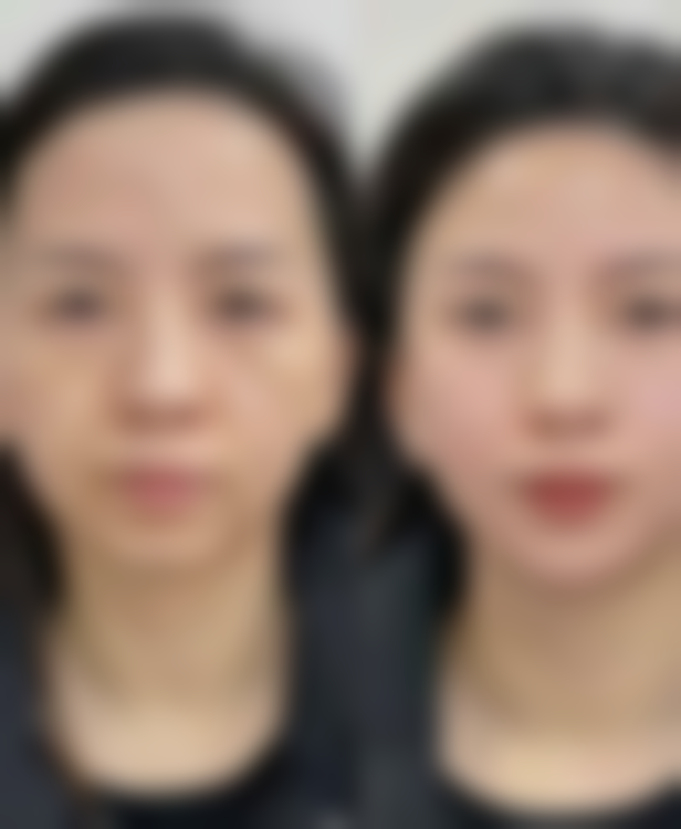 二、韩国爱博ever皮肤科医院正规吗?来看看医院资质: