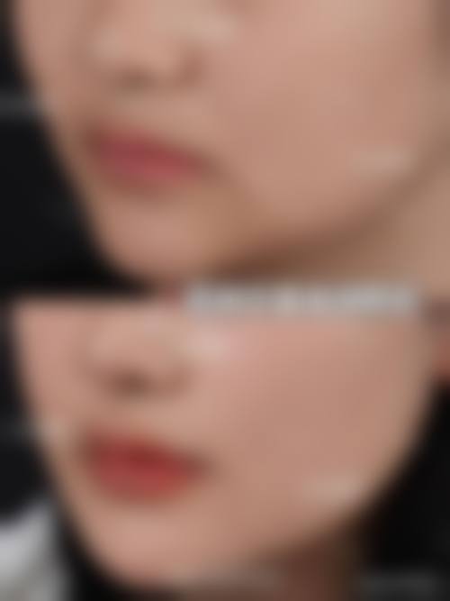 八、哈尔滨壹美整形医院真实的顾客评价如下：