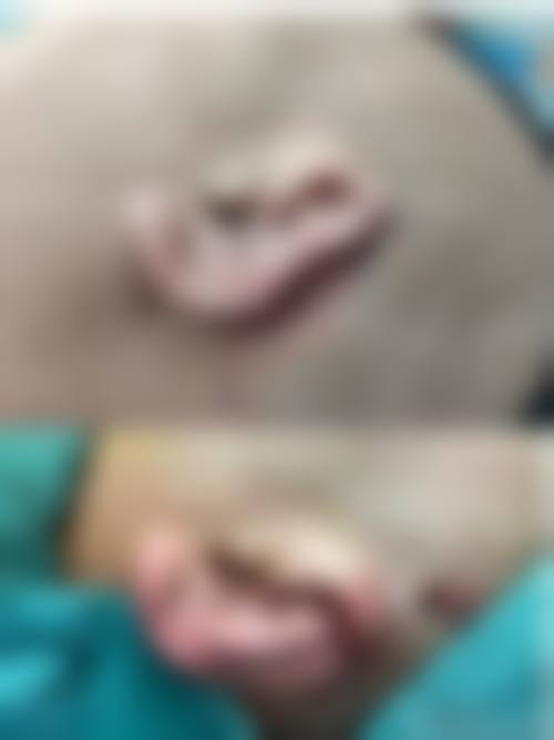 四、哈尔滨壹美整形医院开展的主要项目和特色项目：