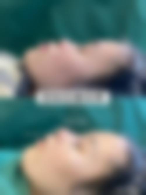 六、温州芮柏整形医院怎么预约：