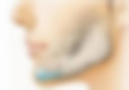 骨粉隆鼻取出有啥特殊情况?怎么处理才好