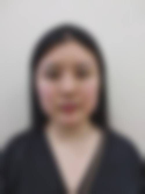 六、佛山梦露医学整形美容门诊部怎么预约: