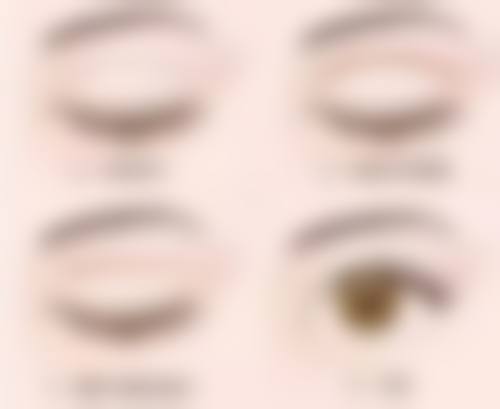黑眼圈并非眼袋！从核心表现、成因到改善方式，带你深度揭秘两者区别 
