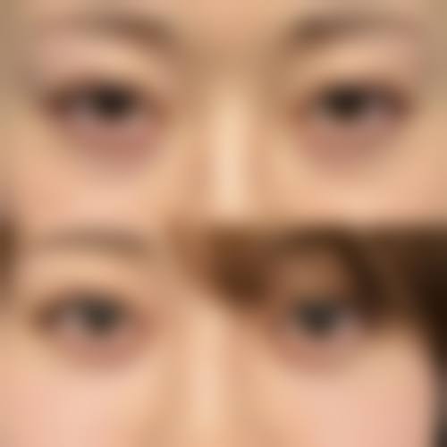 七、长春西之米整形美容医院价格表(仅供参考)