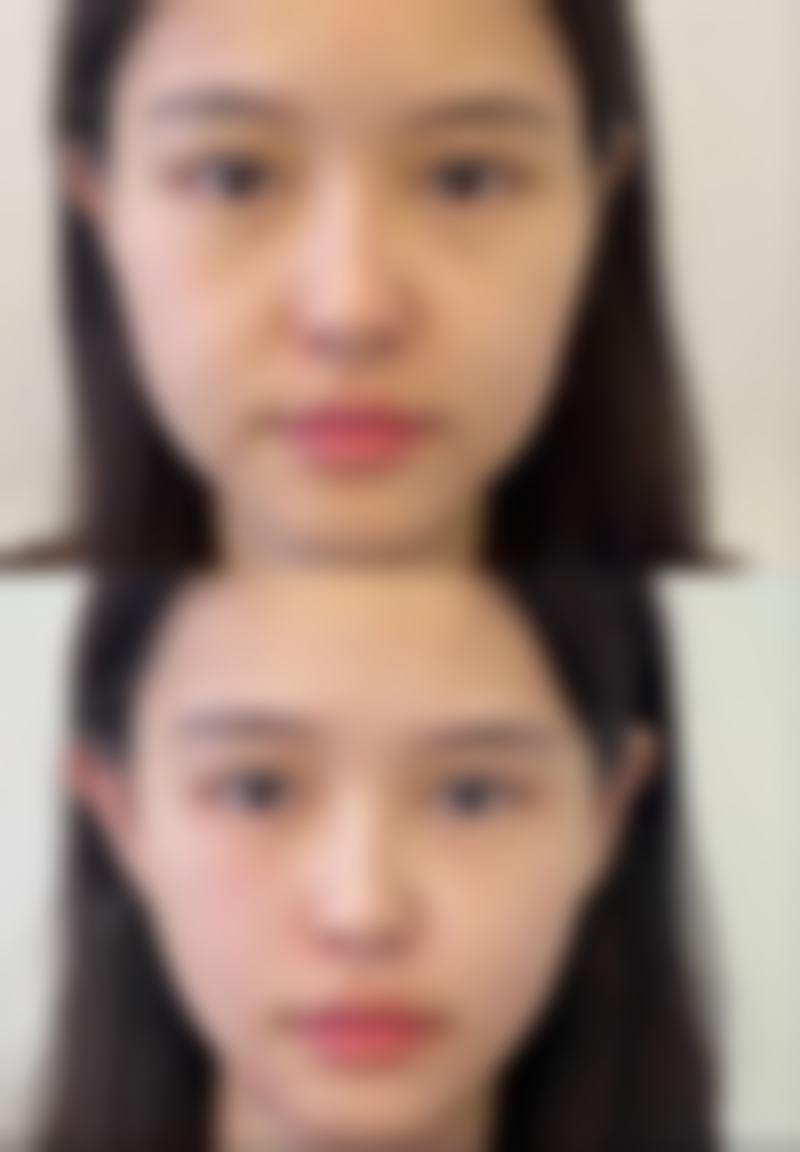 二、南京安欣(原蓓思丽)医疗美容门诊部正规吗?来看看医院资质: