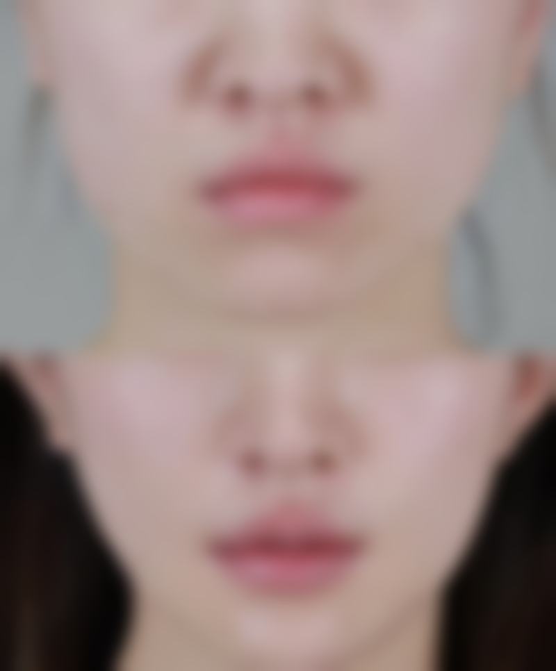 黑眼圈并非眼袋!通用注意事项要牢记