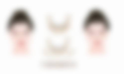 割双眼皮后闭眼困难别慌！查明原因做护理，多数1 - 3个月恢复正常闭眼功能