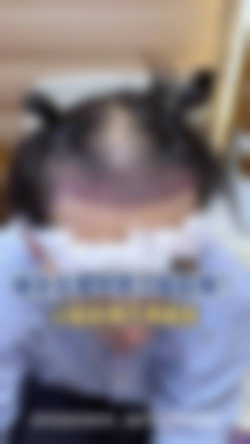 八、武汉碧莲盛植发真实的顾客评价如下: