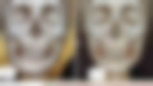 抽脂100毫升脂肪是否需要休息?通用抽脂手术的休息建议
