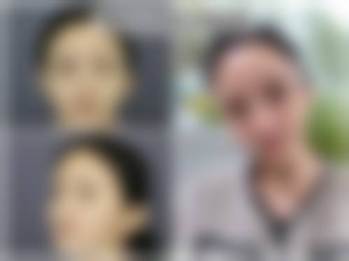 六、广东揭阳莱美医疗美容怎么预约: