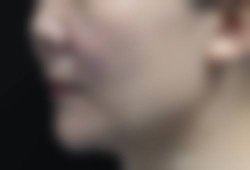 朱科旋医生实例