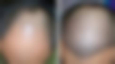 六、包头摩登尹丽霞医学美容诊所价格表:(仅供参考)