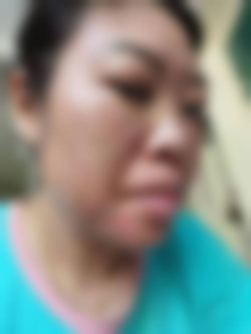 三、温岭市第一人民医院(医疗美容科)医生介绍: