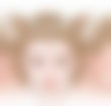 想知道轻度/早期眼袋的至佳物理治疗方法?多种方式按需选