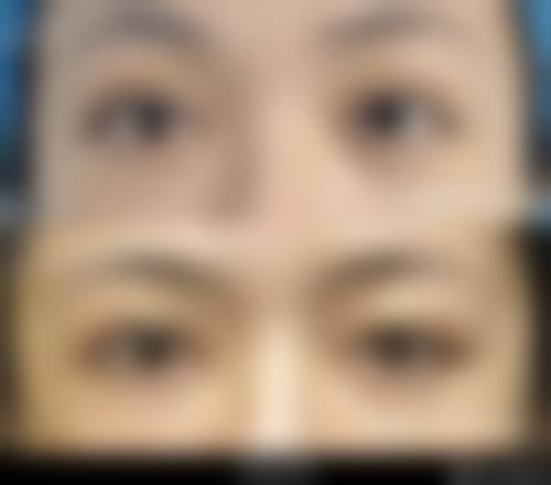 七、哈尔滨超龙医疗美容医院价格表:(仅供参考)
