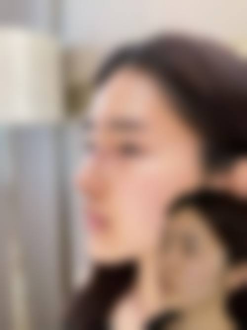 八、徐相宇整形外科真实的顾客评价如下: