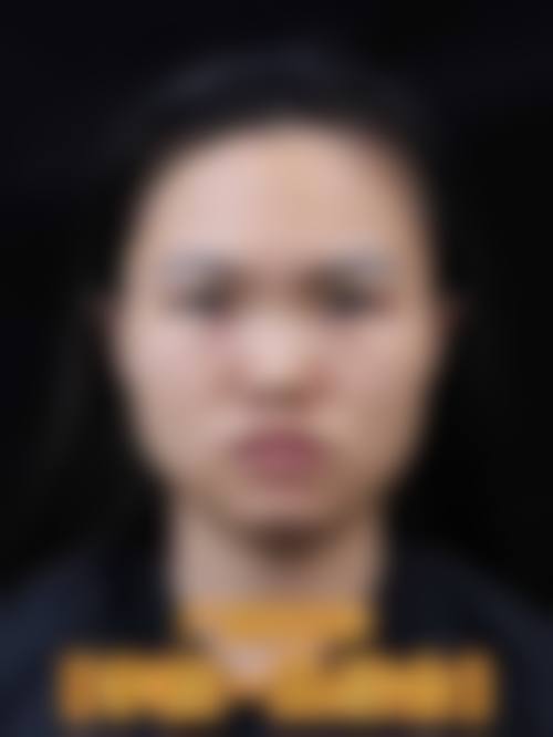 樊辉华医生怎么样可靠吗？