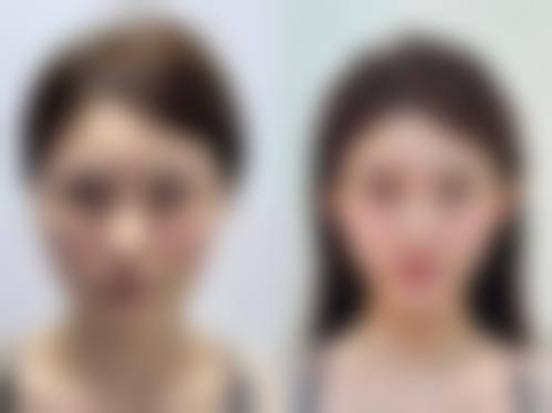 八、湖北江汉油田总医院整形美容科真实的顾客评价如下：