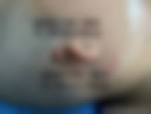 杨剑军 医生实例