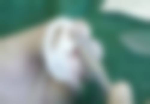 轻微烫伤后红色疤痕如何去除？多种疗法+日常护理，助你半年左右淡化疤痕 