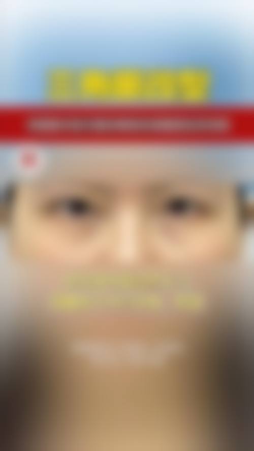 八、sone整形外科真实的顾客评价如下: